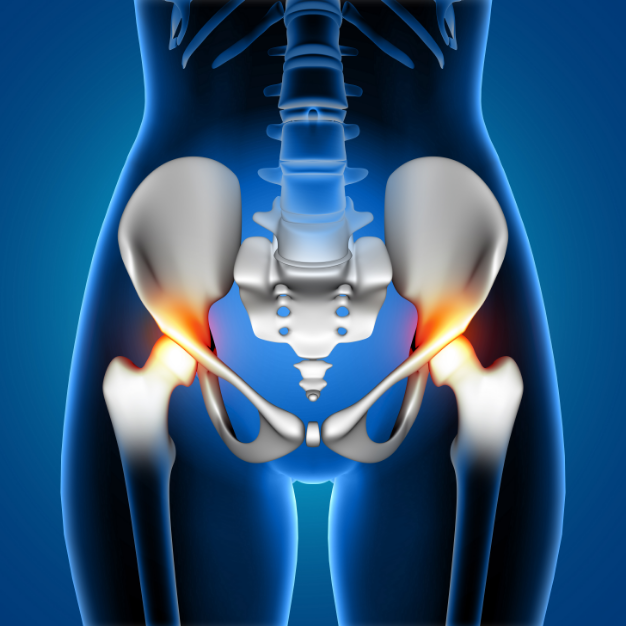 Total Hip Replacement Surgery | Hip Surgeon in Adelaide | Ortho Precision | Dr Yas Edirisinge