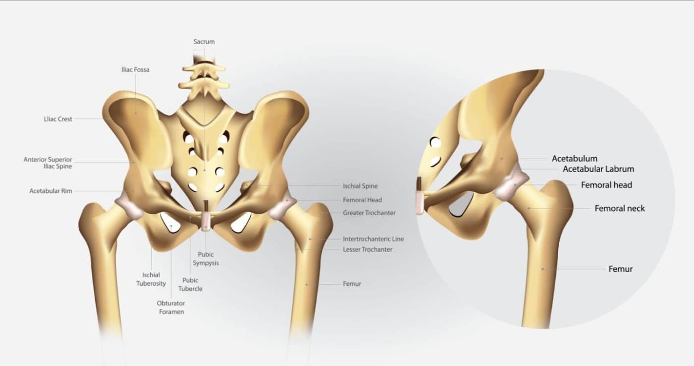 What is femoroacetabular impingement?