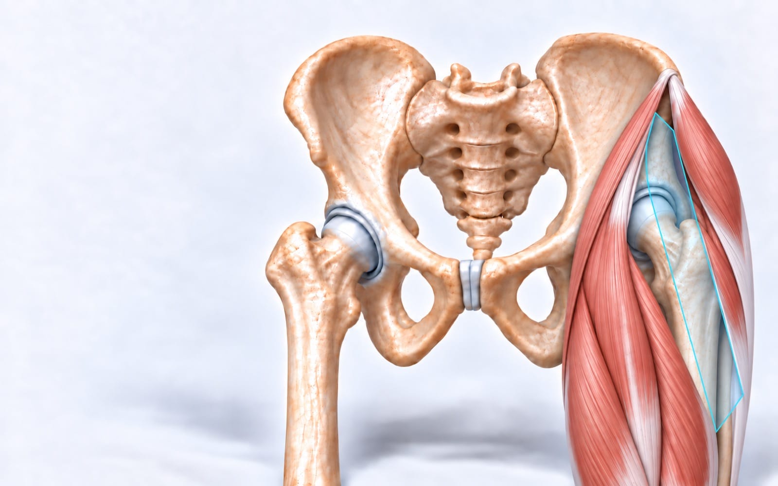 Three-dimensional front view of the pelvis and hip, with a cyan path between intact muscles showing the anterior approach.