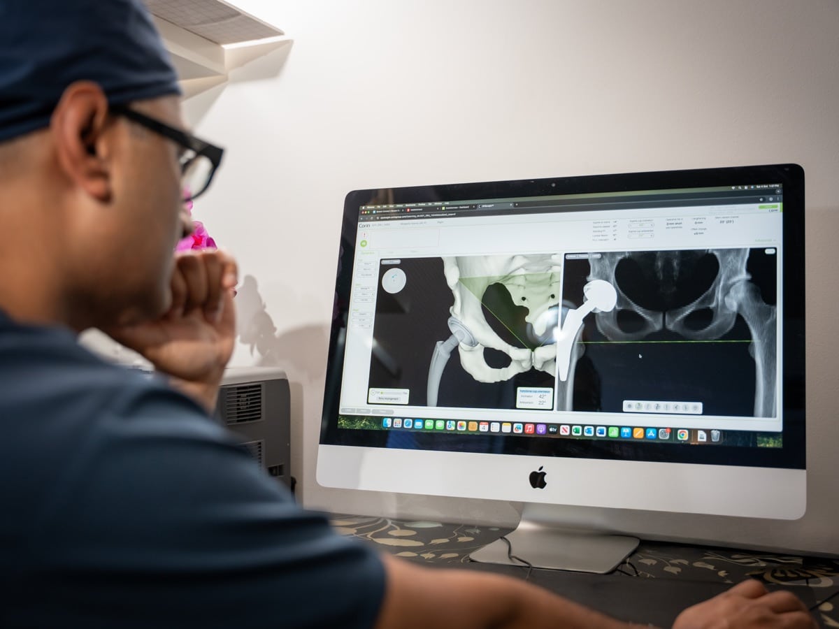 Dr Yas Edirisinghe reviewing three-dimensional hip replacement planning and pelvic imaging on a computer screen.