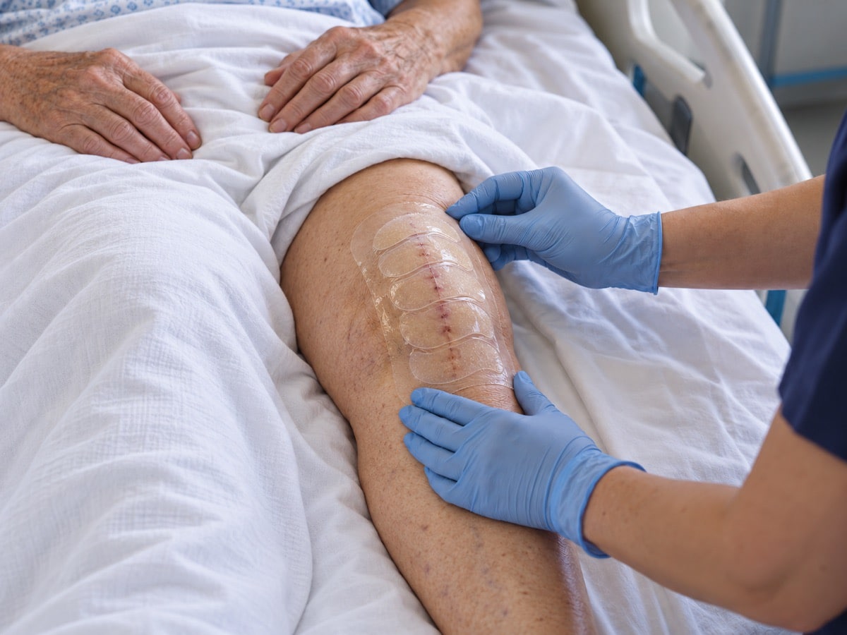 Gloved nursing hands secure a transparent dressing over a closed knee incision while the patient rests.